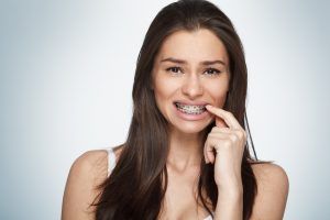 La ortodoncia no provoca recesión gingival