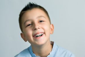 Tipos de ortodoncia para niños