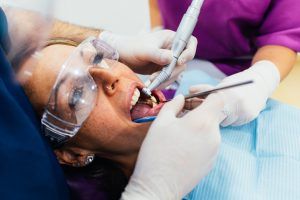 implantes dentales y periodontitis