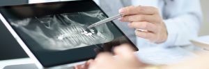 implantes dentales ortodoncia