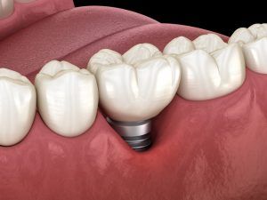 mucositis