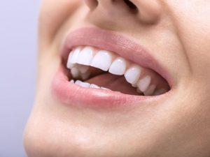 los dientes